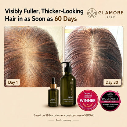 Glamóre Grow hair loss serum promotional graphic showing before-and-after hair density results on two scalp photos labeled Day 1 and Day 30, with the product bottles and award badges below.